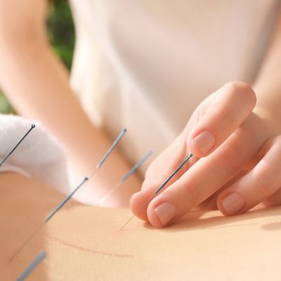 Link to: /physiotherapy/acupuncture
